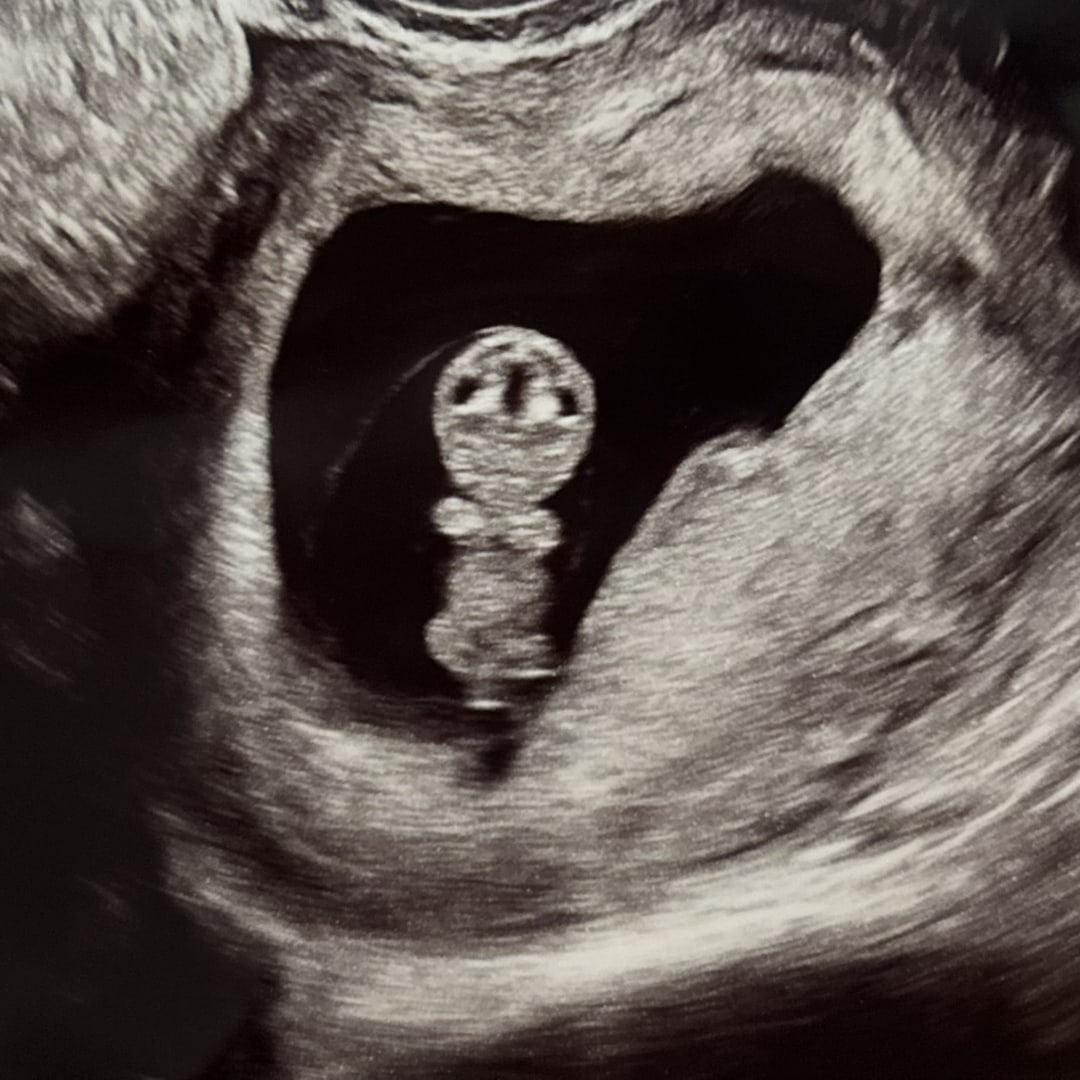 Photo shared by London for their Babylist baby registry.