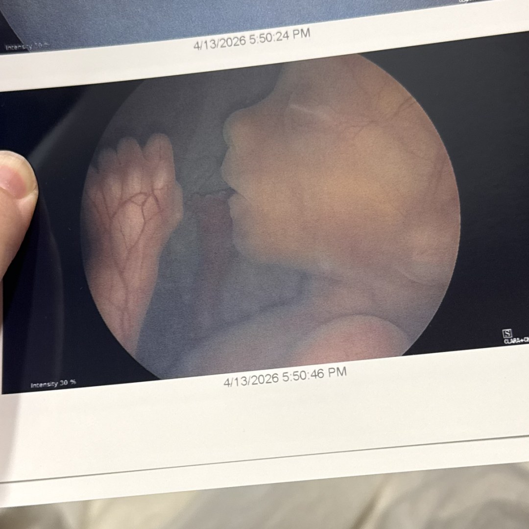 Photo shared by Mary for their Babylist baby registry.