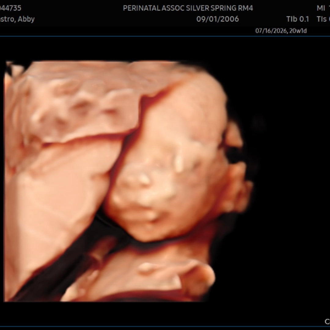 Photo shared by Abby for their Babylist baby registry.