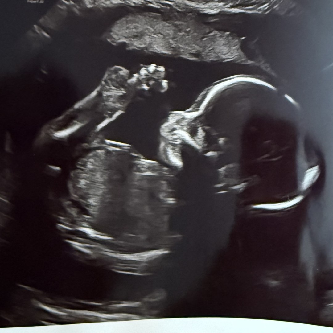 Photo shared by Madyson for their Babylist baby registry.