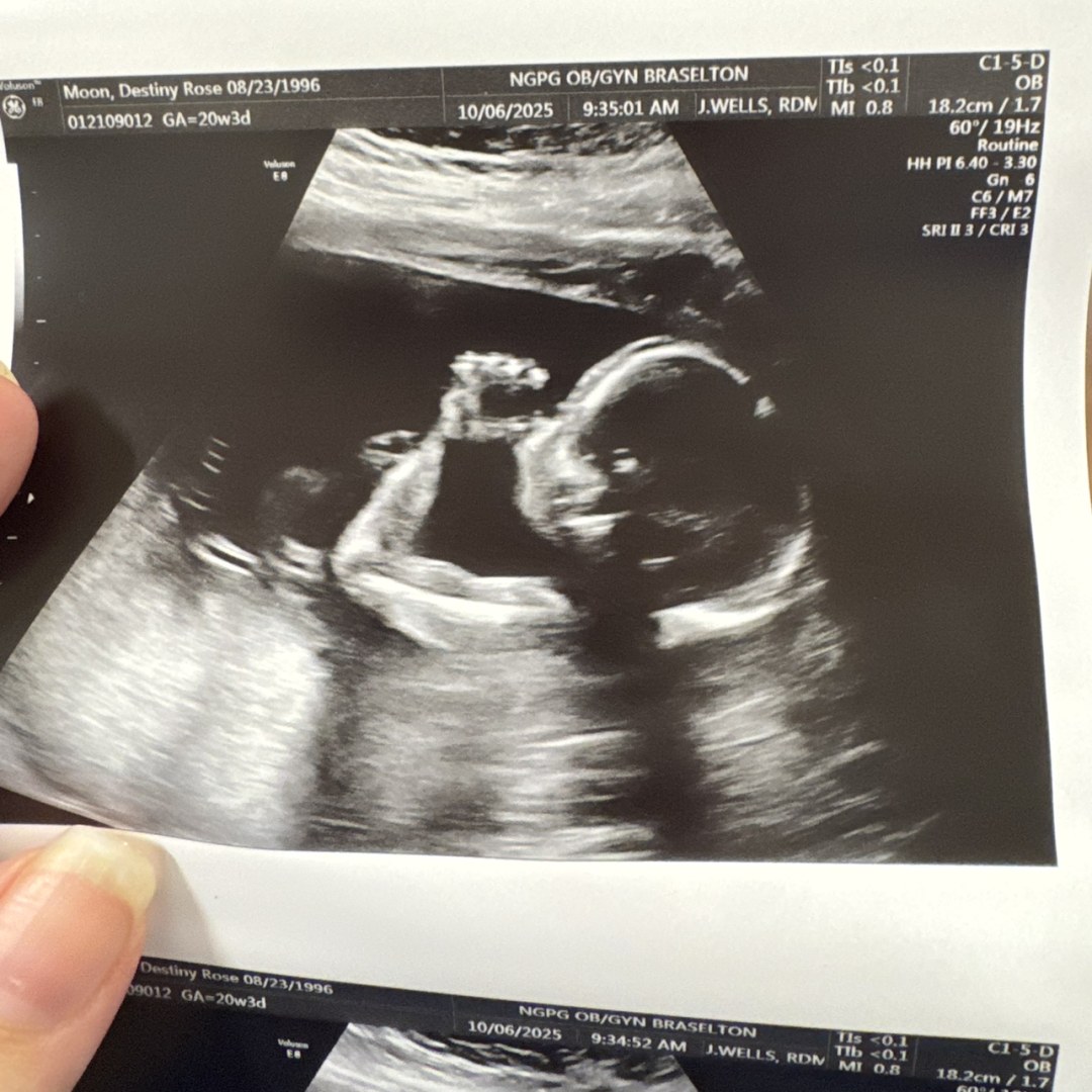 Photo shared by Destiny for their Babylist baby registry.