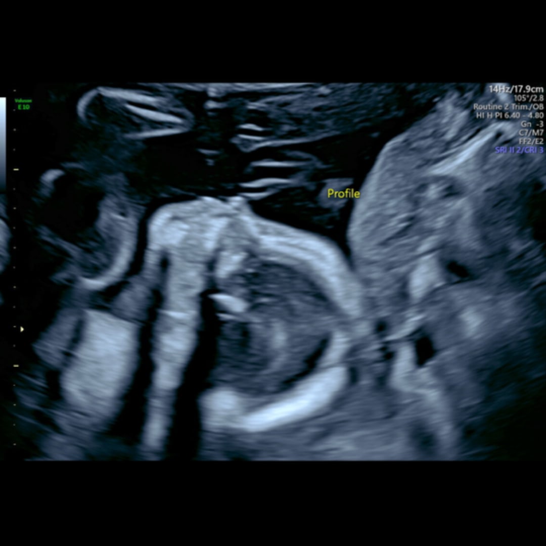 Photo shared by Abby for their Babylist baby registry.