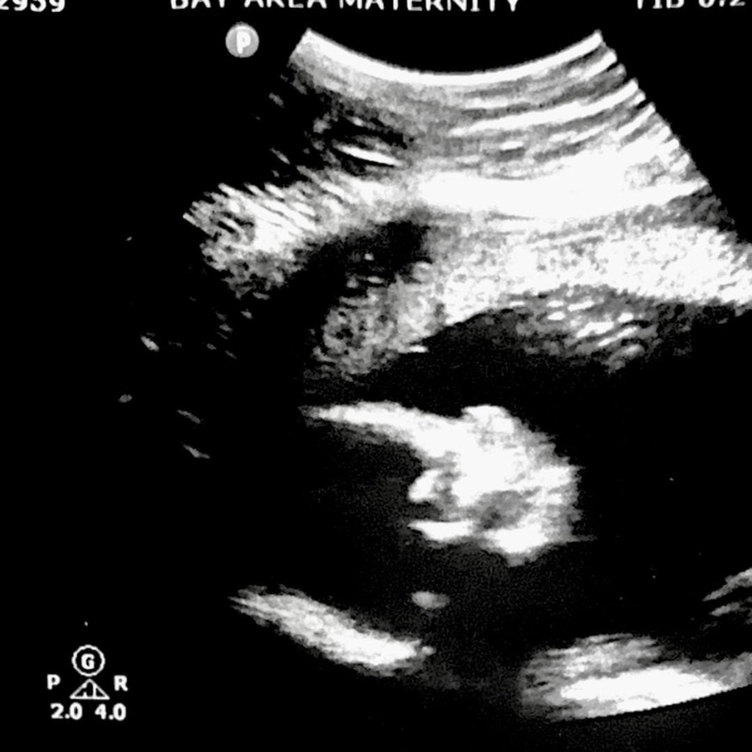 Photo shared by Ashlyn for their Babylist baby registry.