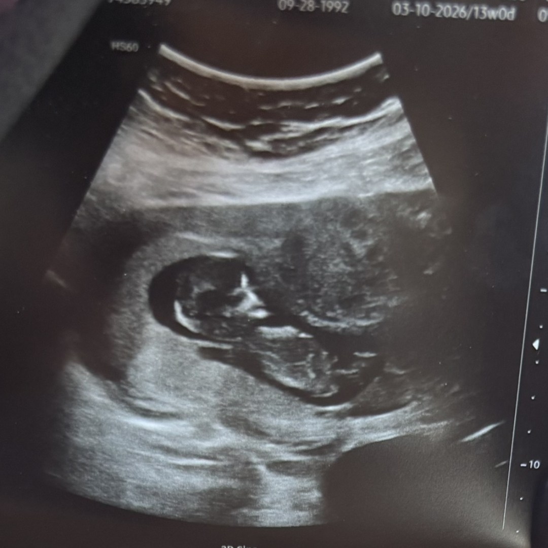 Photo shared by Andrea for their Babylist baby registry.