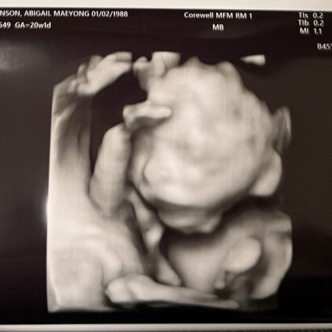 Photo shared by Abby for their Babylist baby registry.