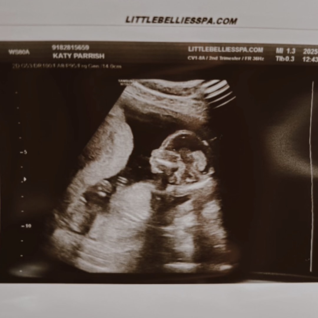 Photo shared by Katy for their Babylist baby registry.