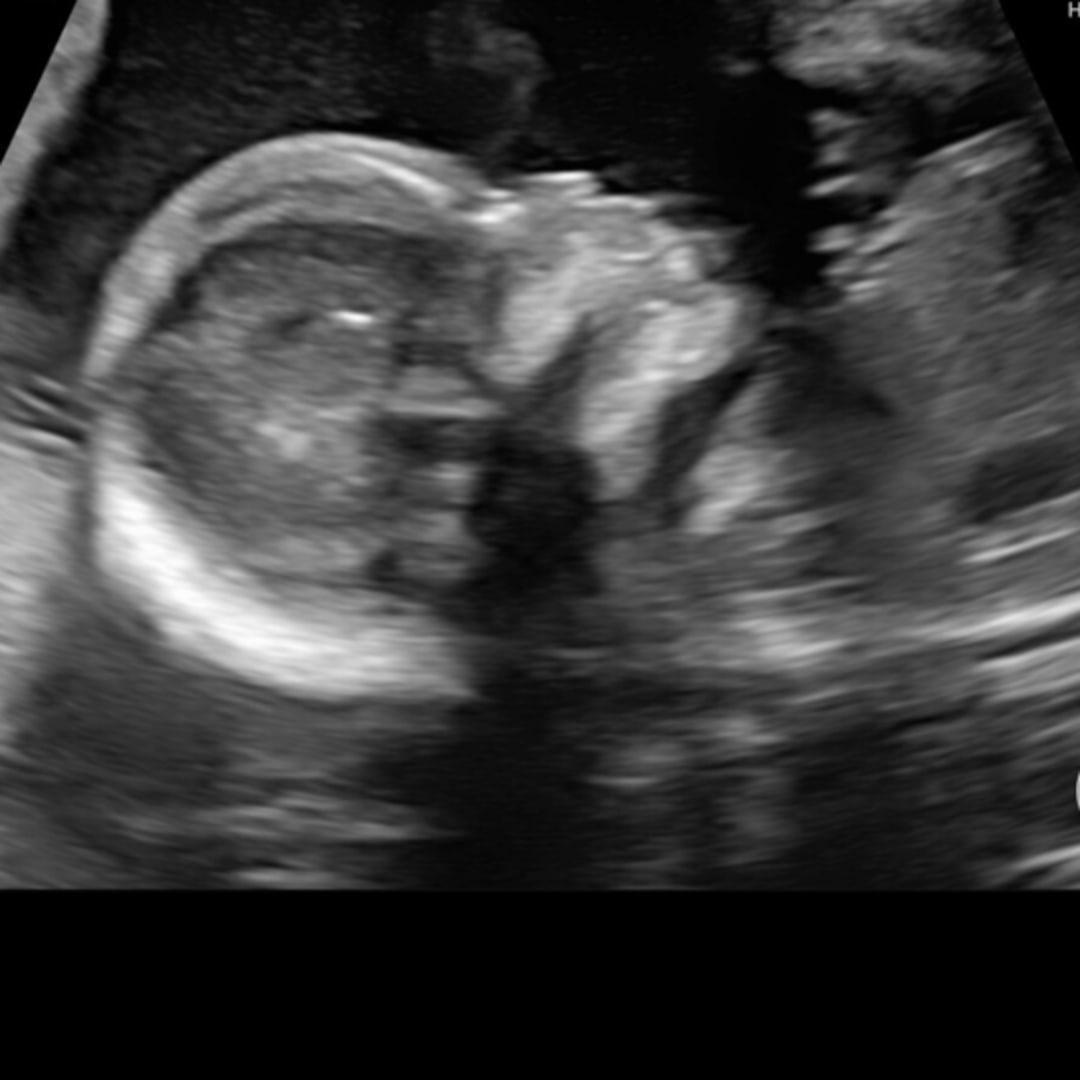 Photo shared by Steven for their Babylist baby registry.