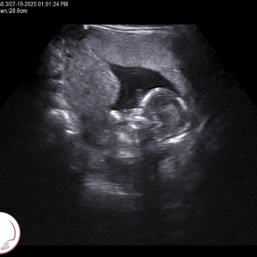 Photo shared by Camia for their Babylist baby registry.