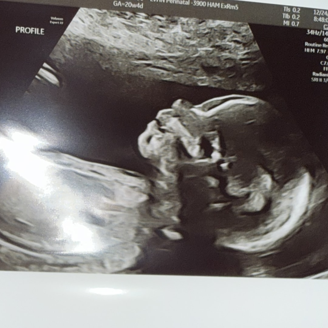 Photo shared by Kailyn for their Babylist baby registry.