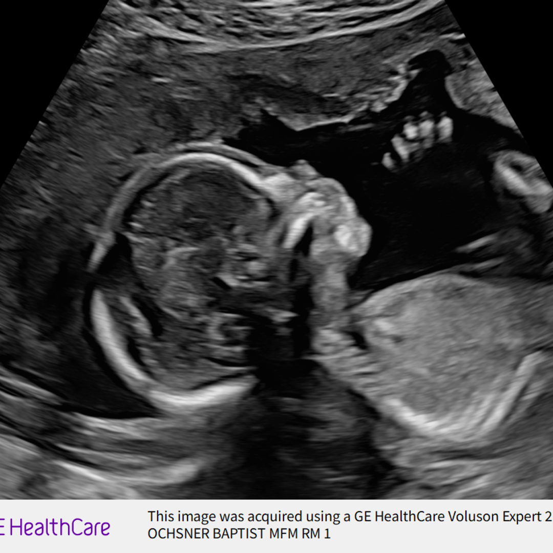 Photo shared by Anjelica for their Babylist baby registry.