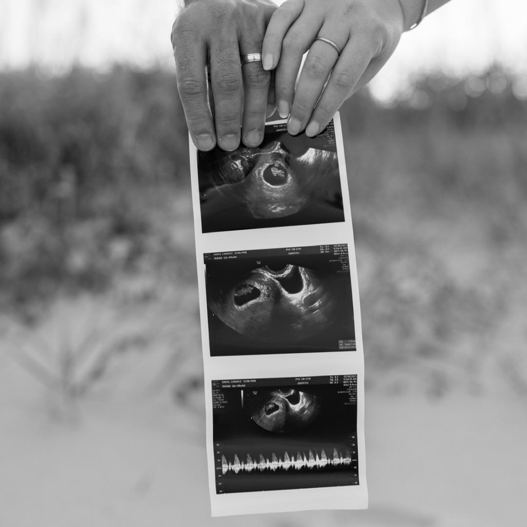 Photo shared by Candice for their Babylist baby registry.