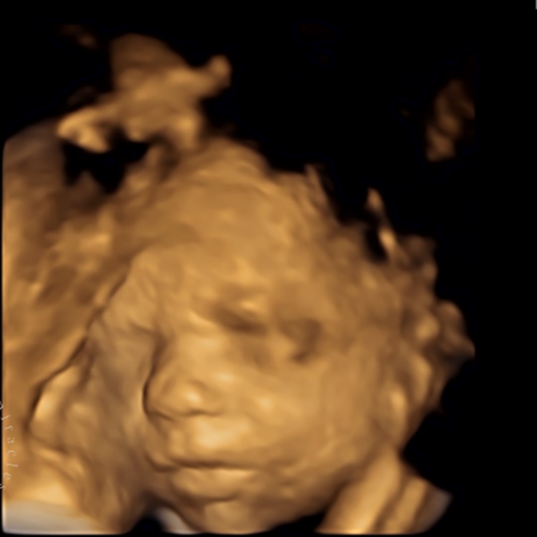 Photo shared by Emily for their Babylist baby registry.