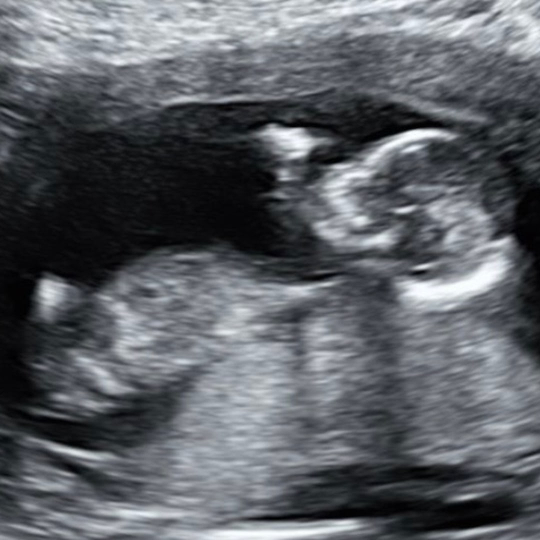 Photo shared by Olivia for their Babylist baby registry.