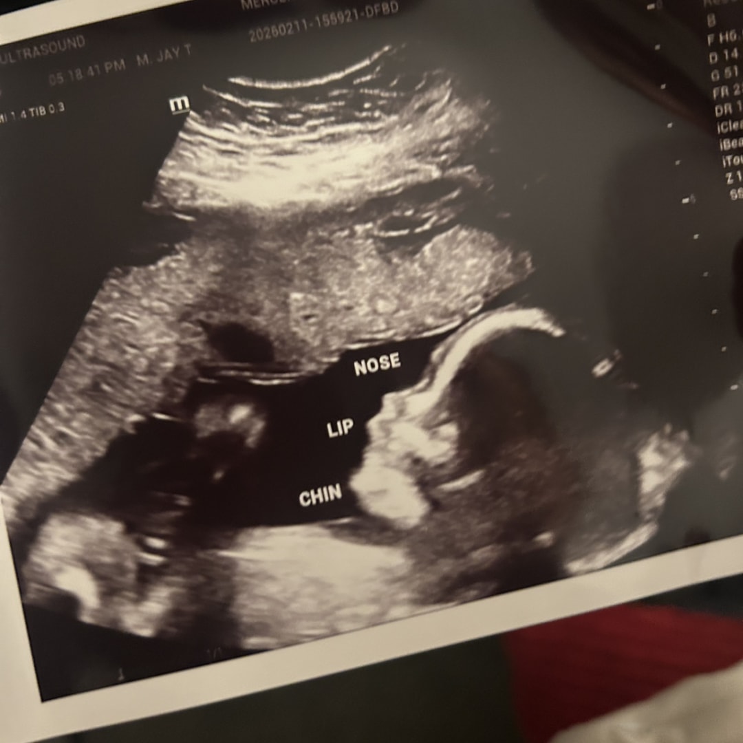 Photo shared by Eliza for their Babylist baby registry.