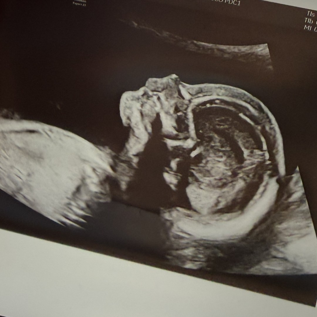 Photo shared by Daniel for their Babylist baby registry.