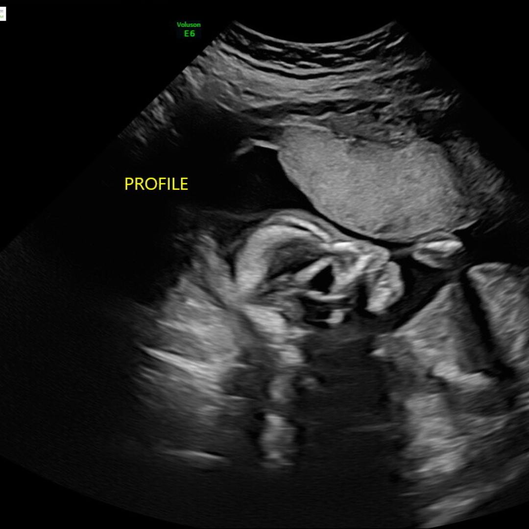 Photo shared by Nercy for their Babylist baby registry.