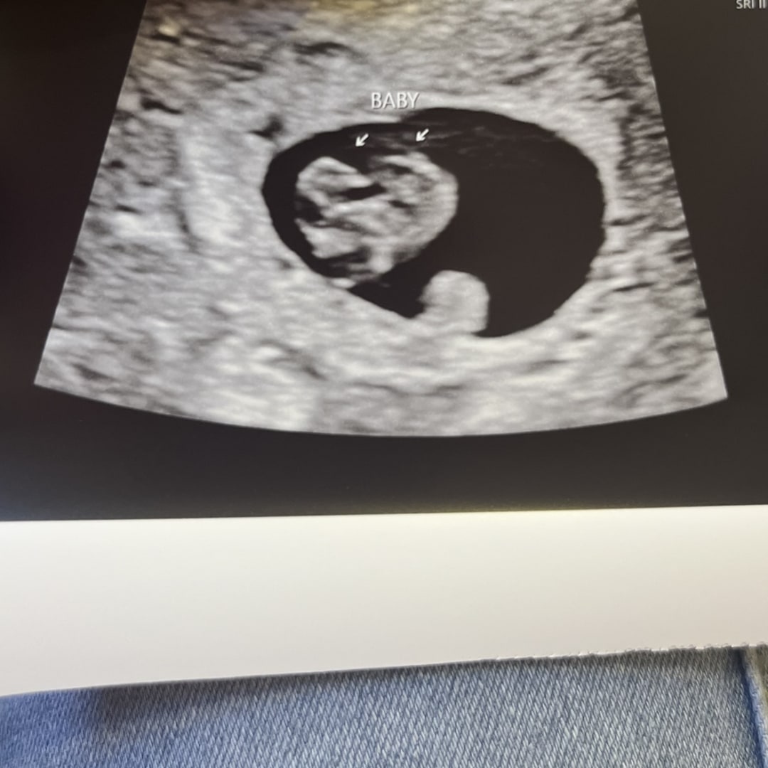 Photo shared by Brii for their Babylist baby registry.