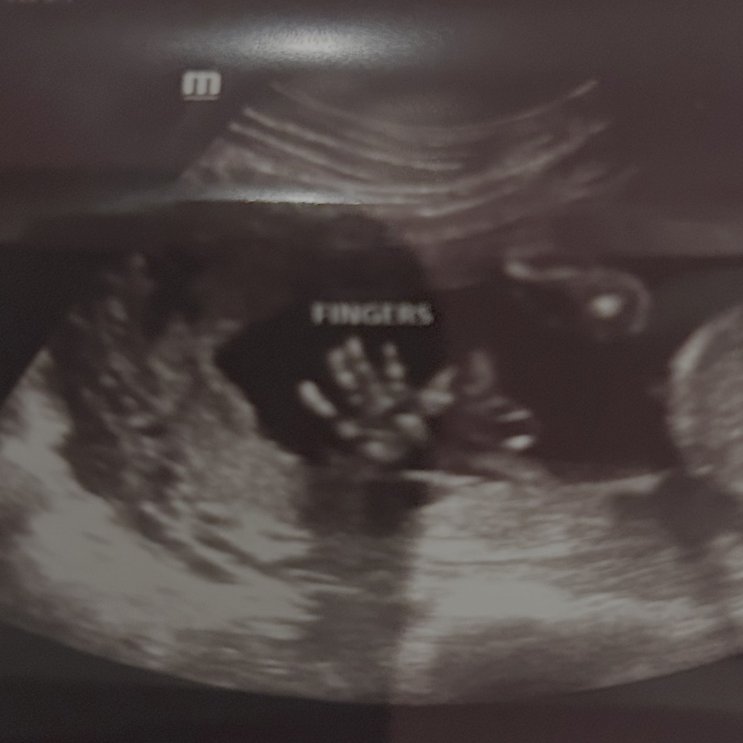 Photo shared by Andrew for their Babylist baby registry.