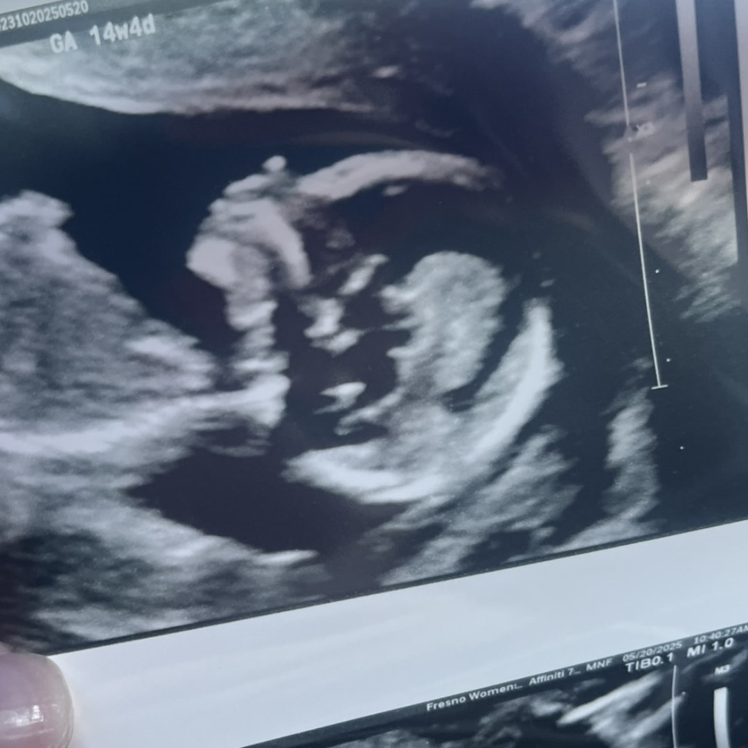 Photo shared by Mychel for their Babylist baby registry.