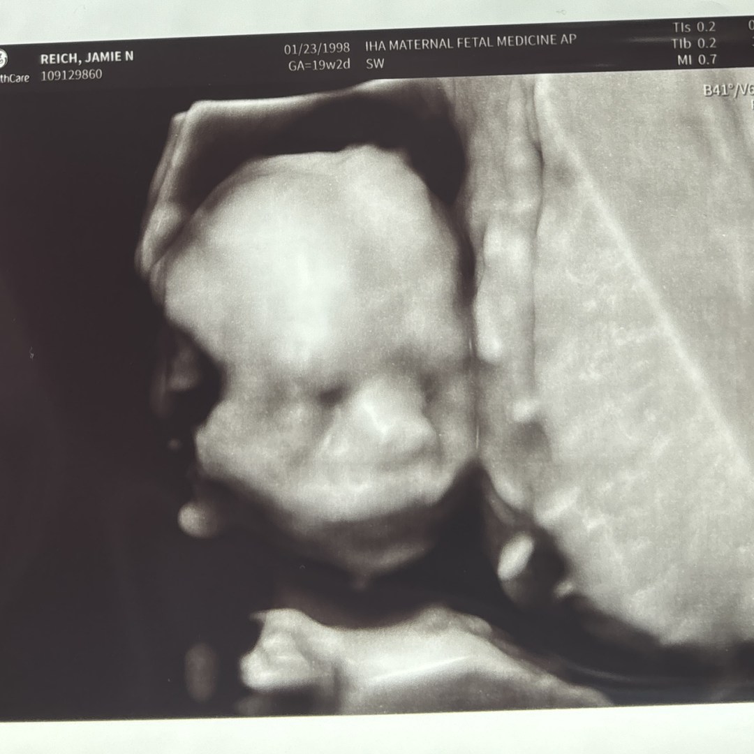 Photo shared by Jamie for their Babylist baby registry.