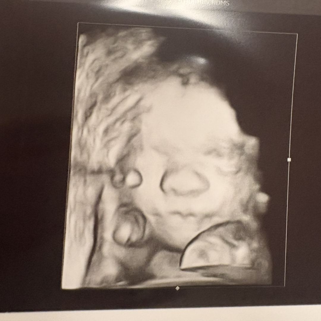 Photo shared by Cate for their Babylist baby registry.