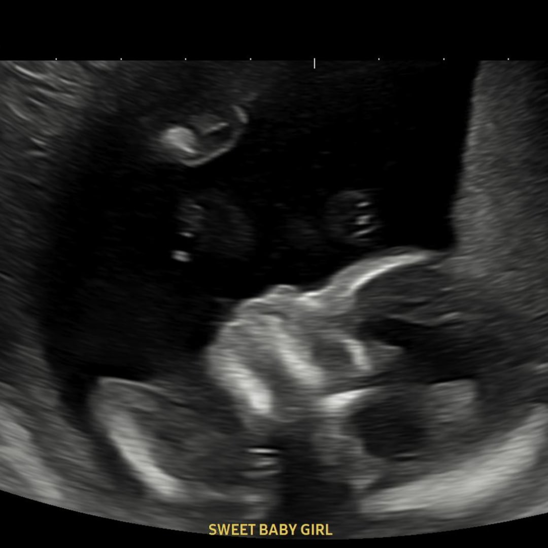 Photo shared by Crystal for their Babylist baby registry.
