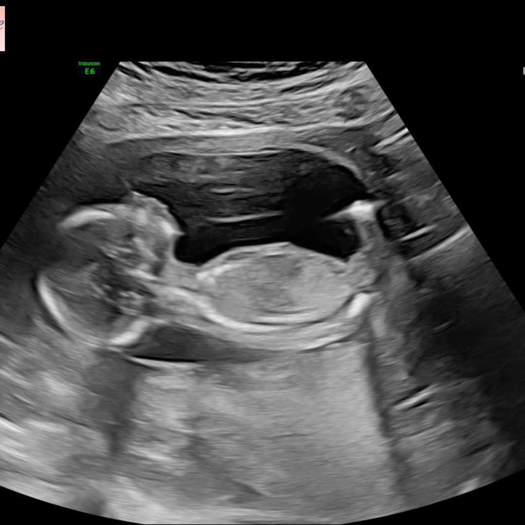 Photo shared by Casandra for their Babylist baby registry.