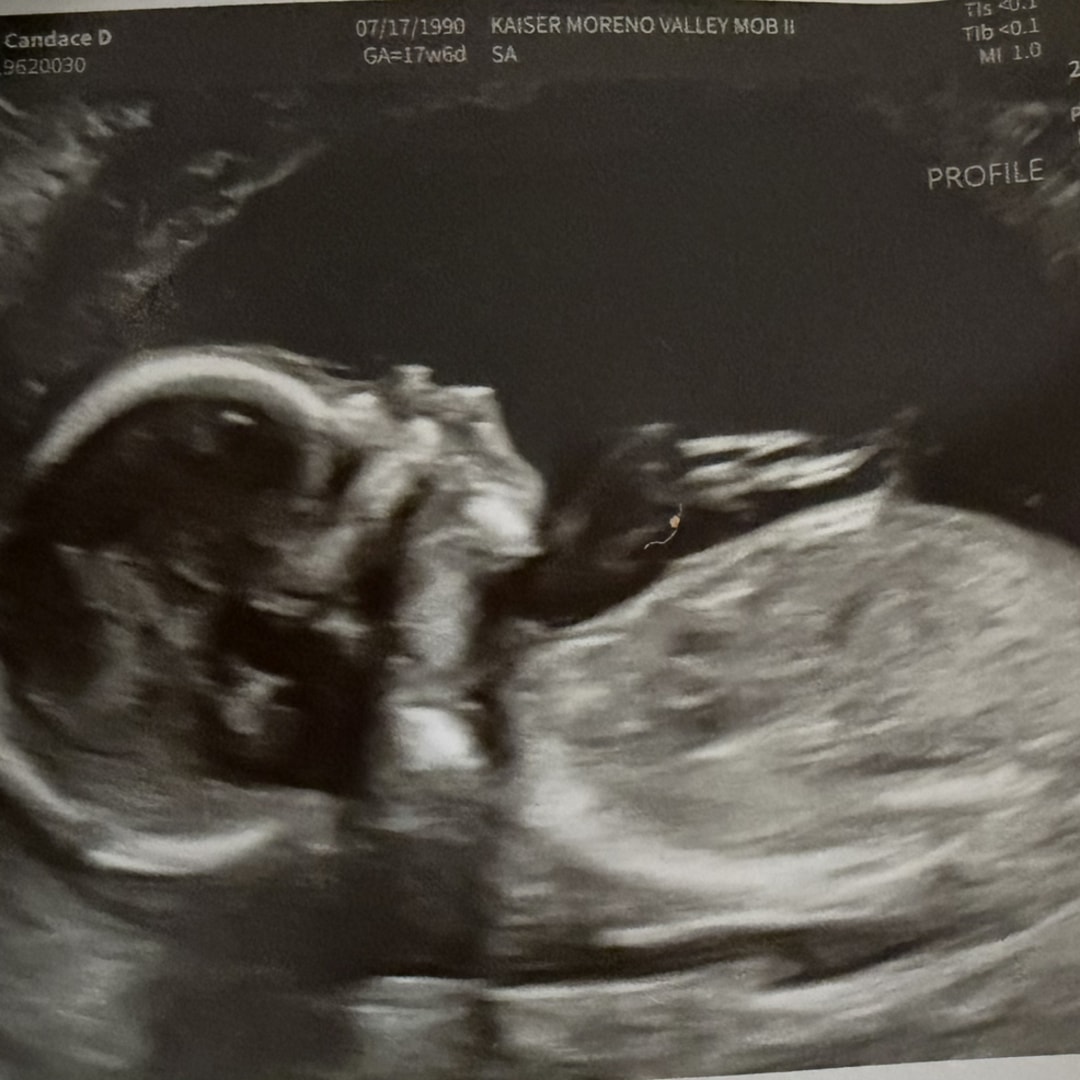 Photo shared by Candace for their Babylist baby registry.