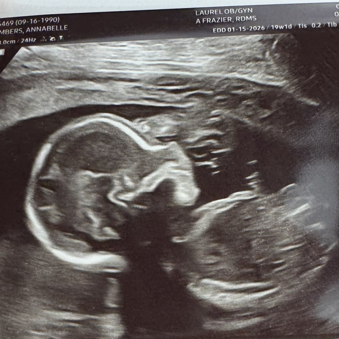 Photo shared by Annabelle for their Babylist baby registry.