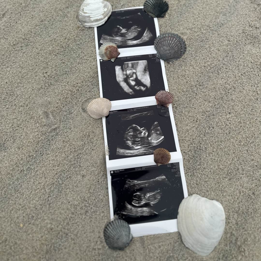 Photo shared by Alexis for their Babylist baby registry.