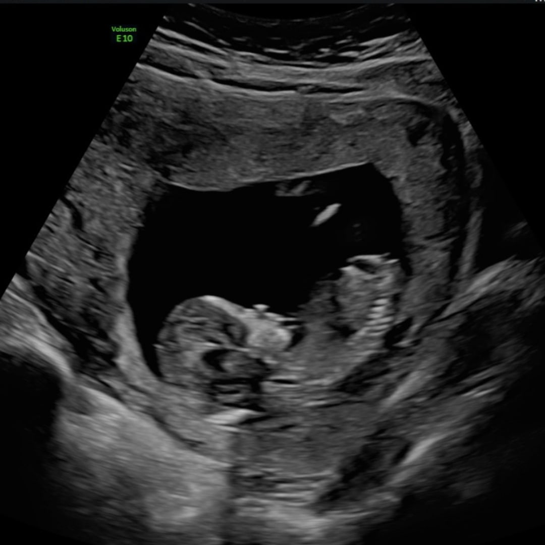 Photo shared by Carlisle for their Babylist baby registry.
