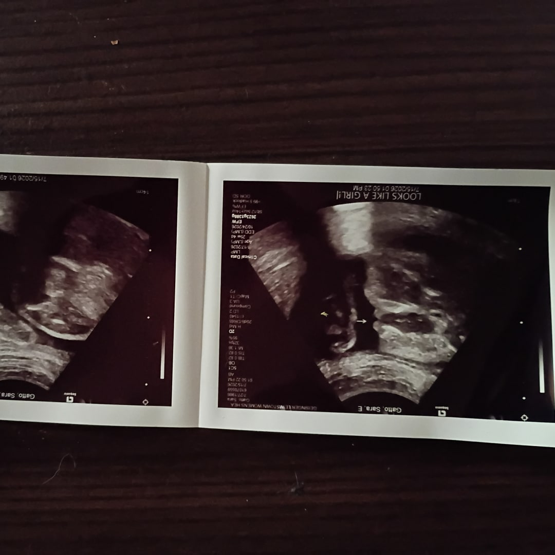Photo shared by Sara for their Babylist baby registry.