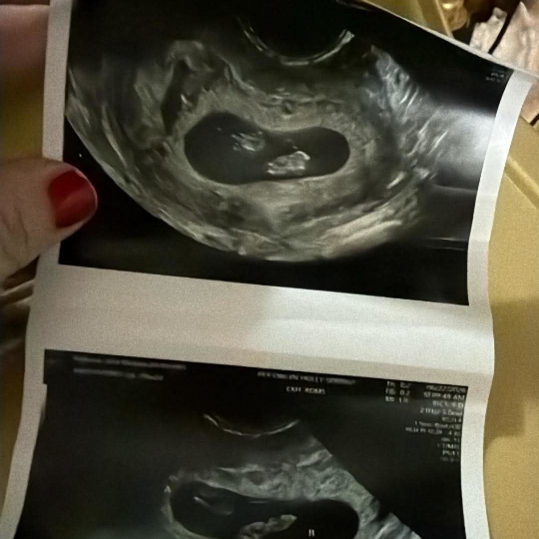 Photo shared by Julia for their Babylist baby registry.
