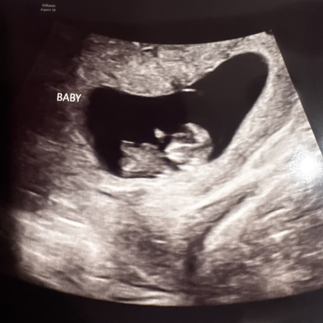 Photo shared by Julia for their Babylist baby registry.