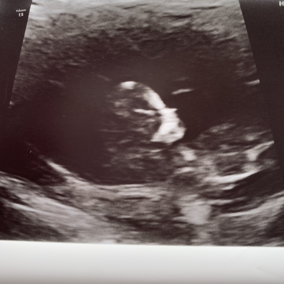 Photo shared by Sarah for their Babylist baby registry.