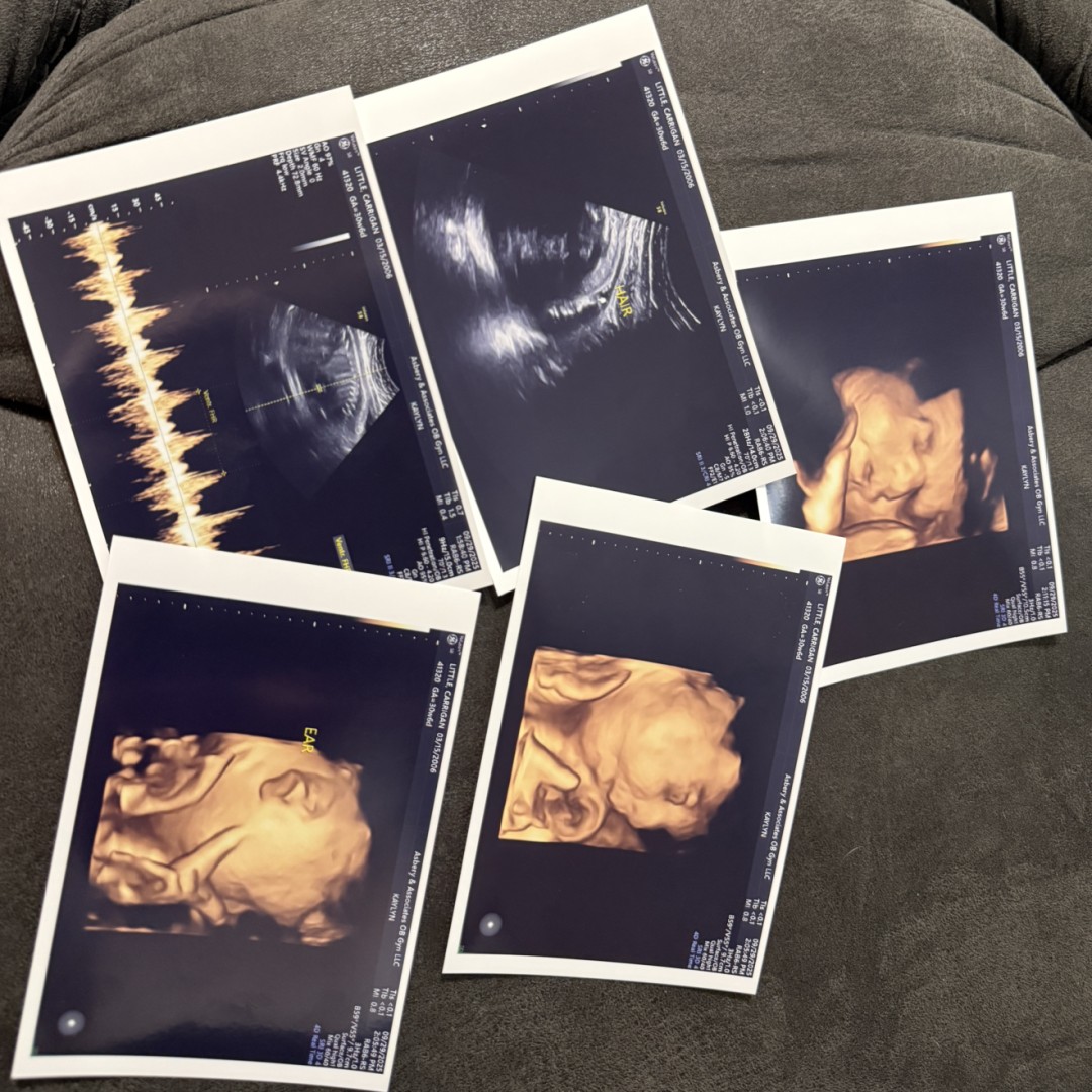 Photo shared by Carrigan for their Babylist baby registry.