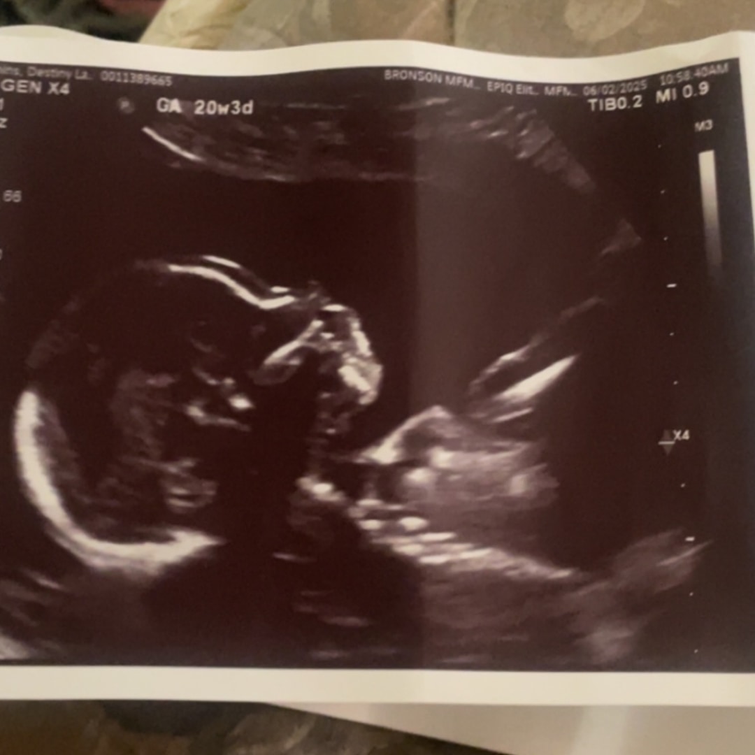 Photo shared by Destiny for their Babylist baby registry.