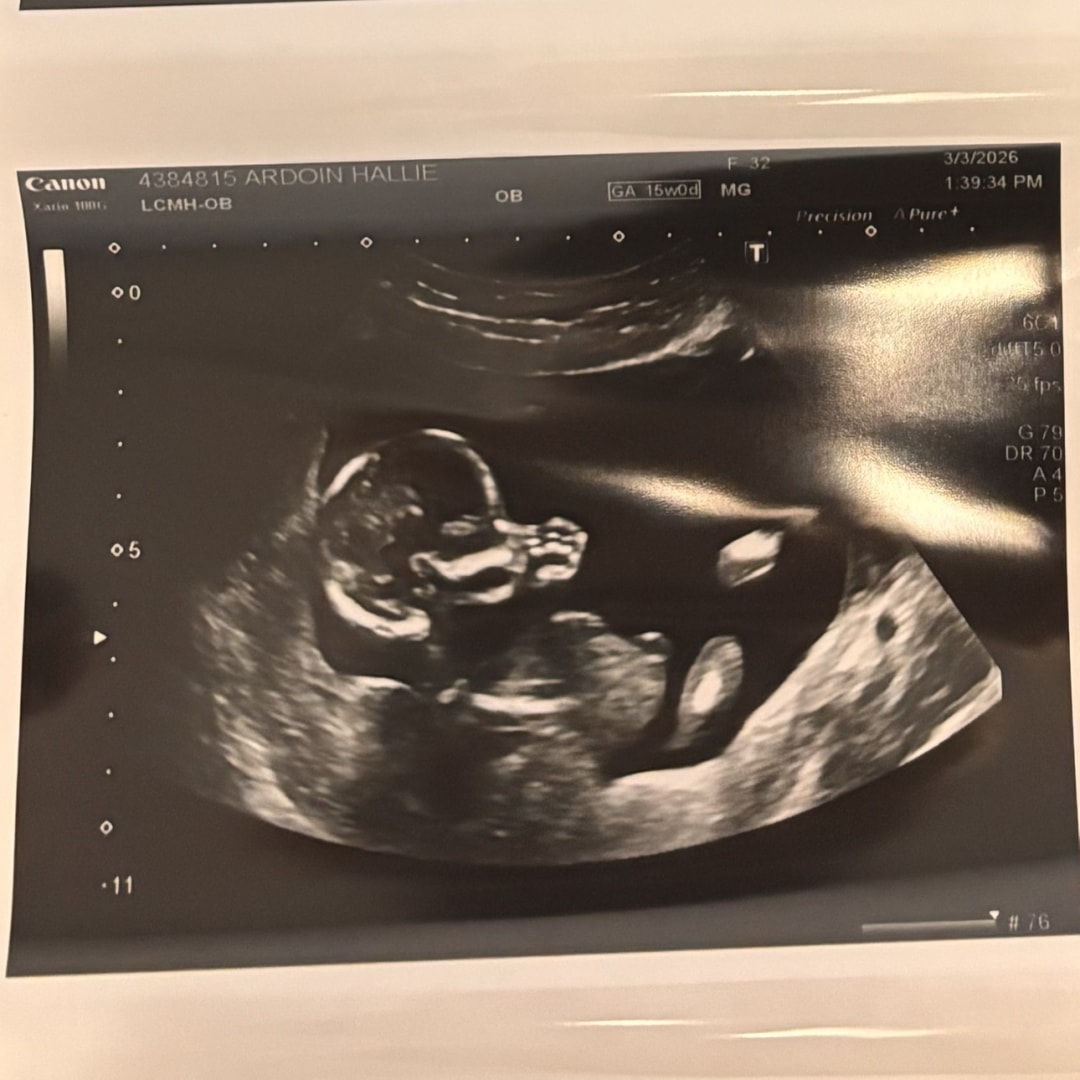 Photo shared by Hailie for their Babylist baby registry.