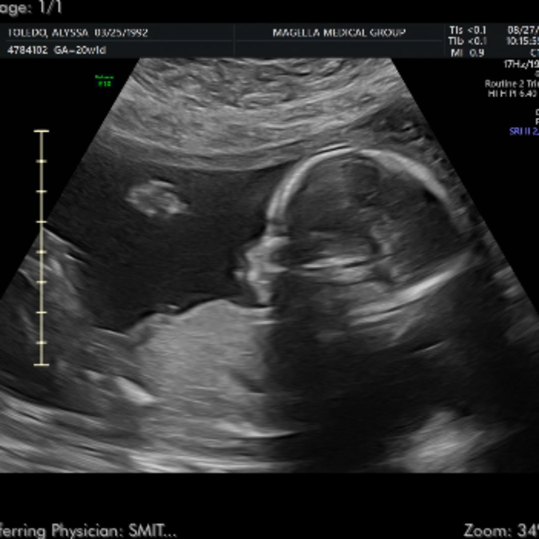 Photo shared by Alyssa for their Babylist baby registry.