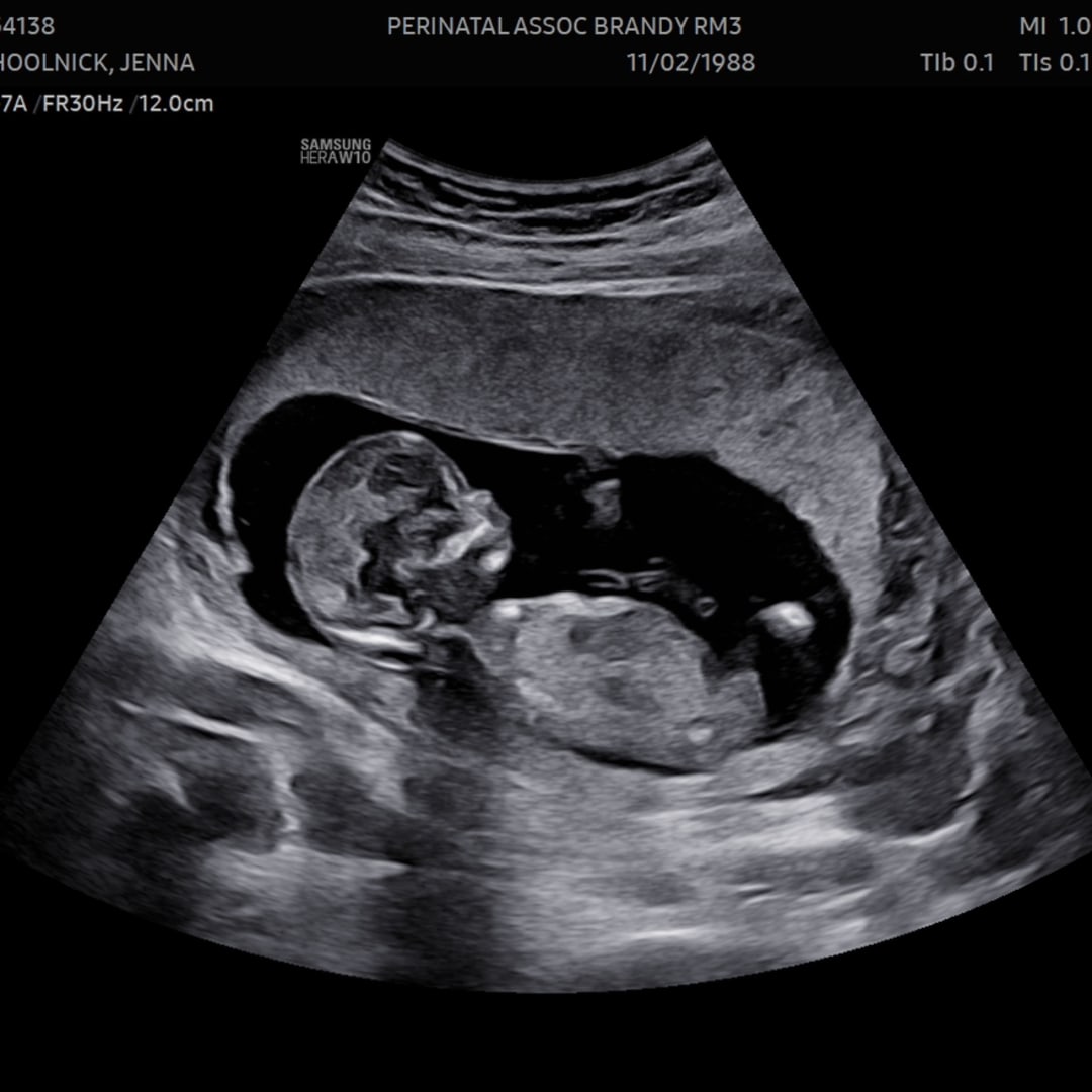 Photo shared by Jenna for their Babylist baby registry.