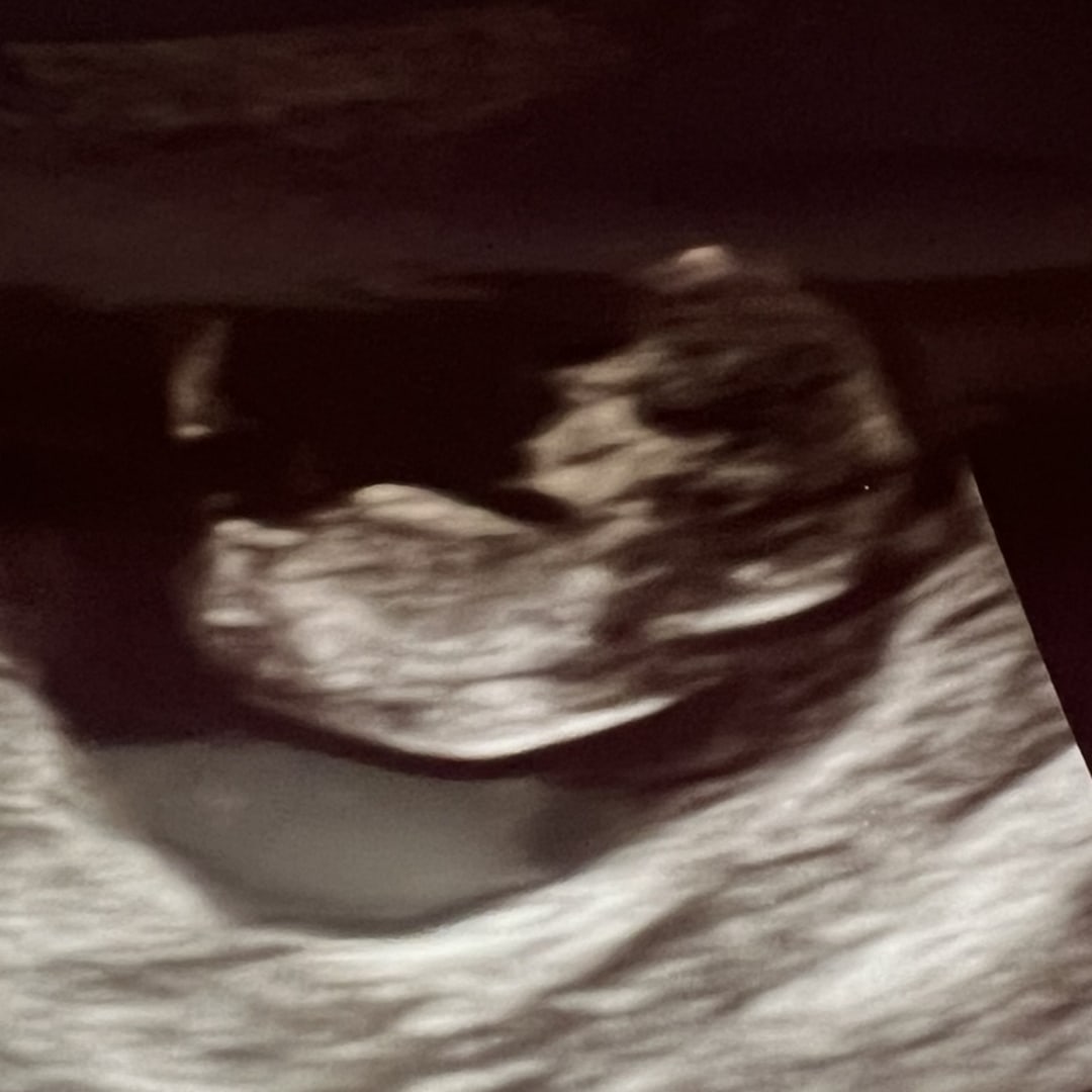 Photo shared by Cassie for their Babylist baby registry.