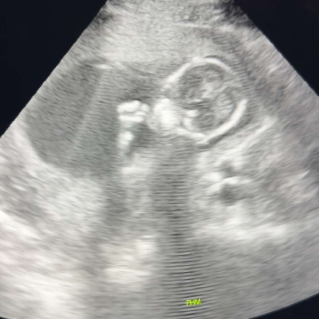 Photo shared by Alyssa for their Babylist baby registry.