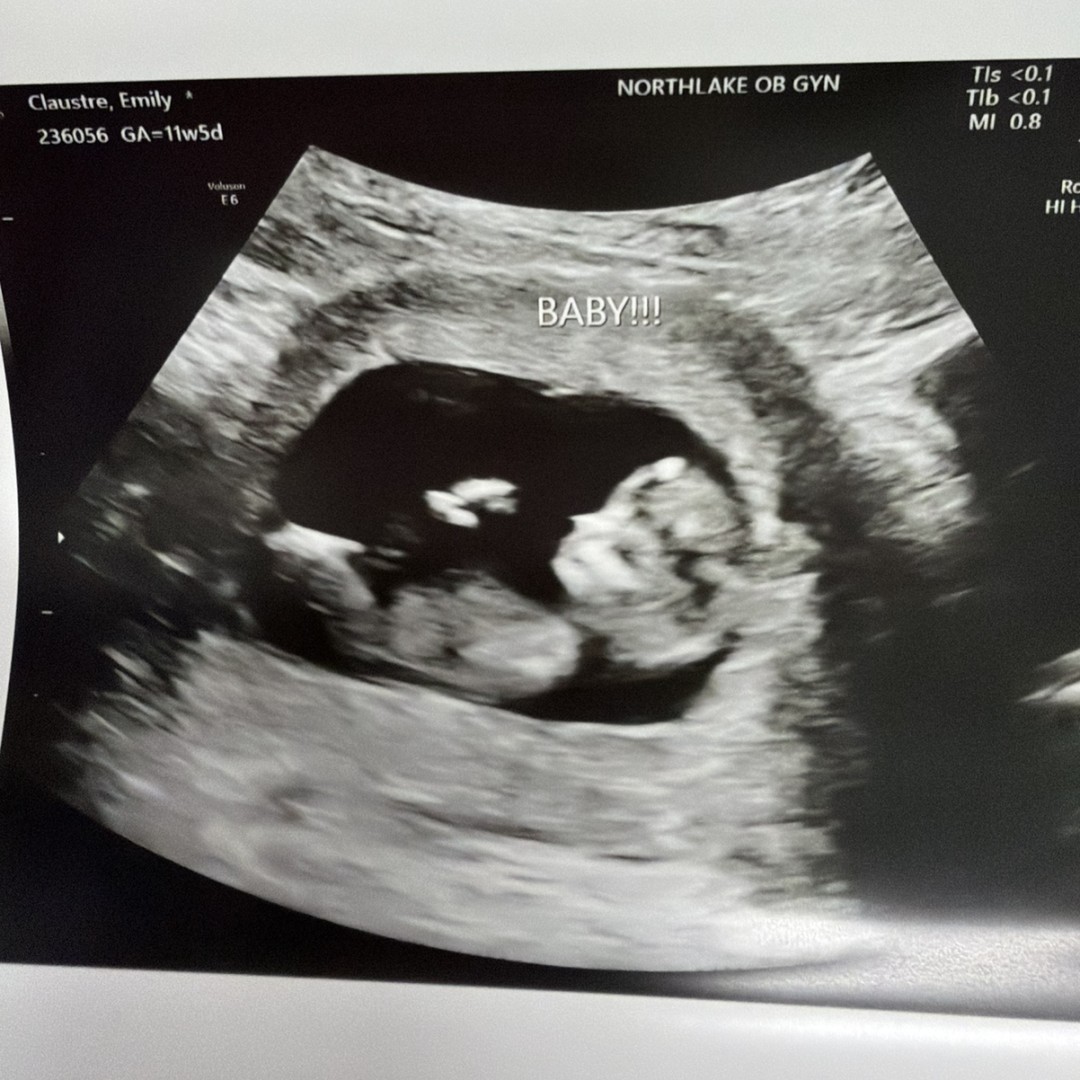 Photo shared by Emily for their Babylist baby registry.