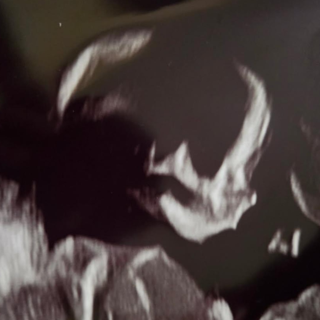 Photo shared by Caitlin for their Babylist baby registry.