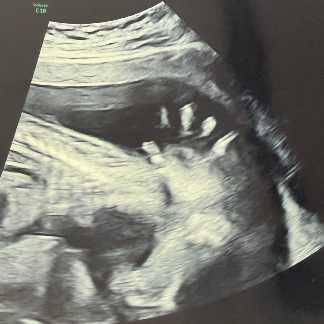 Photo shared by Sukhmanjit for their Babylist baby registry.