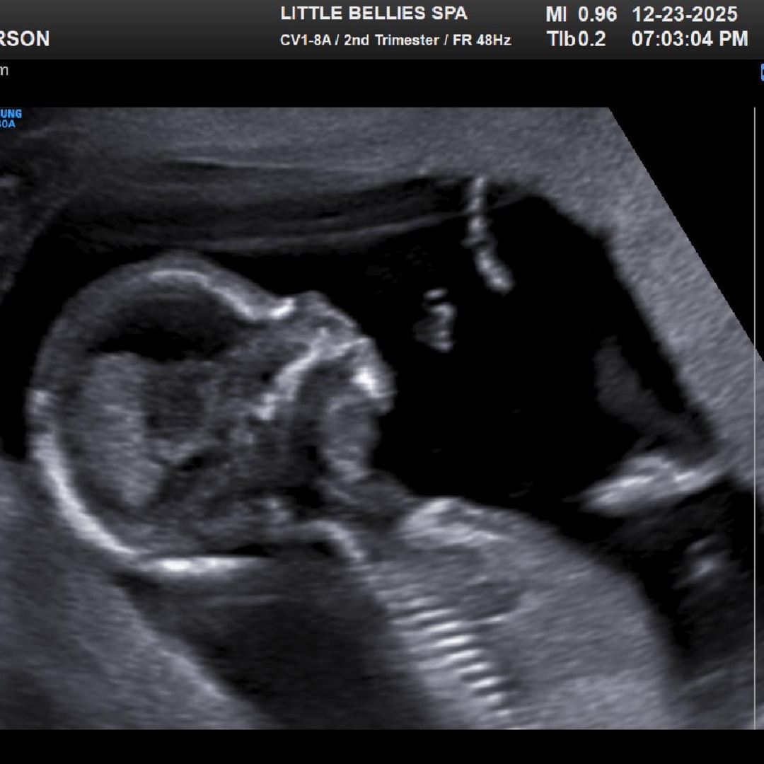 Photo shared by Karson for their Babylist baby registry.