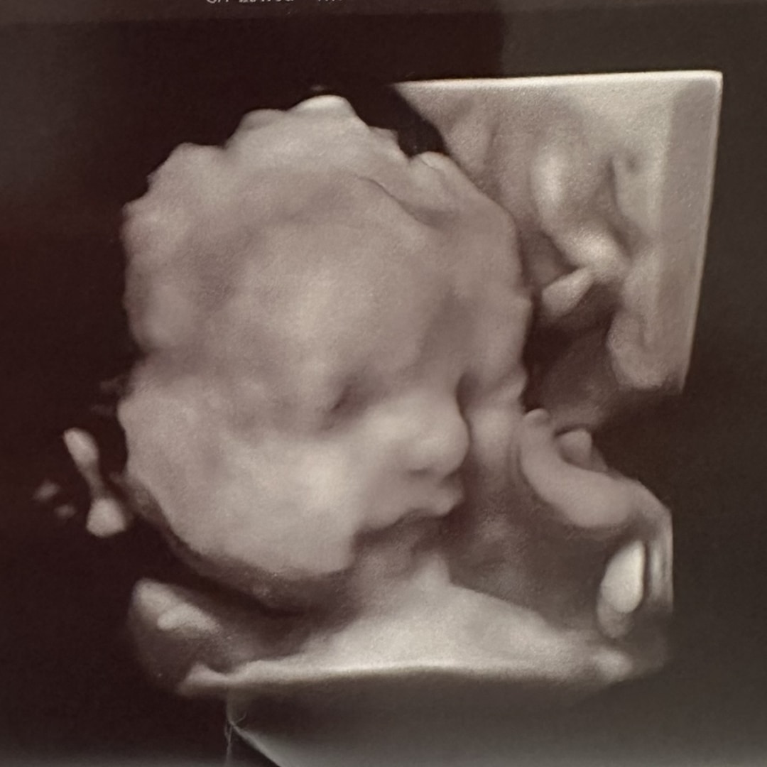 Photo shared by Victoria for their Babylist baby registry.