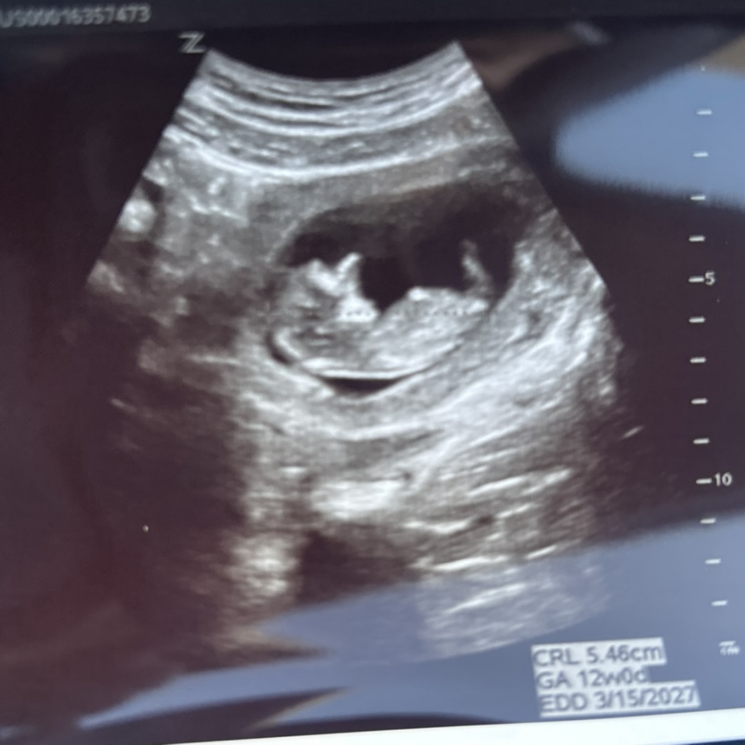 Photo shared by Anais for their Babylist baby registry.