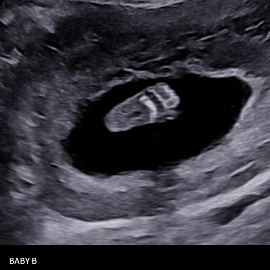 Photo shared by Camila for their Babylist baby registry.