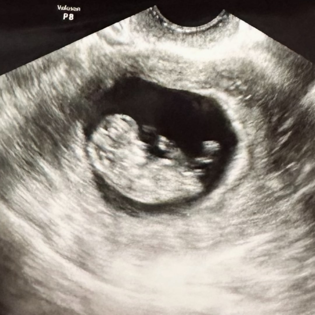 Photo shared by Briana for their Babylist baby registry.